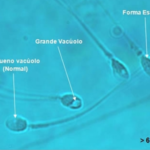 Foto com 4 espermatozoides no microscópio com aumento de 6.000 vezes