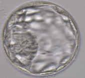 Embrião d5 - blastocisto