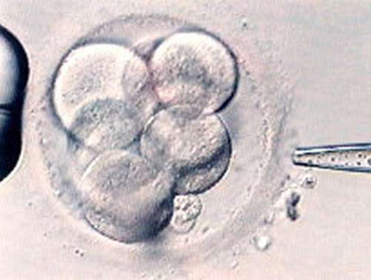 Como o Assisted Hatching facilita a implantação do embrião?