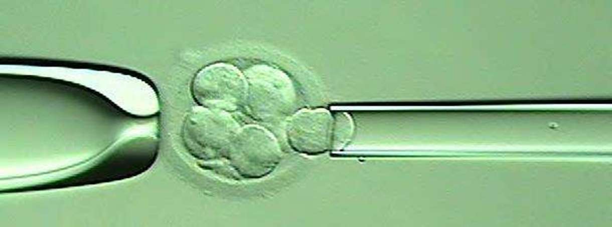9 dúvidas sobre análise genética do embrião 
