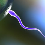 esperma amarelado
