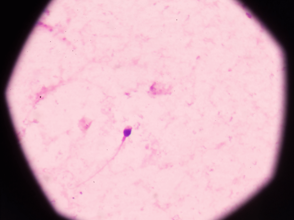 procedimentos para obter espermatozoides
