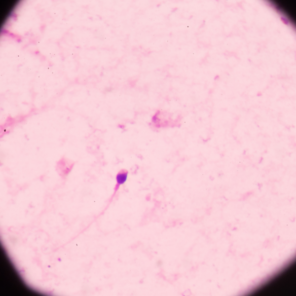 Espermatozoides no microscópio