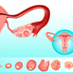 Ovulação: todos os estágios e corpo lúteo