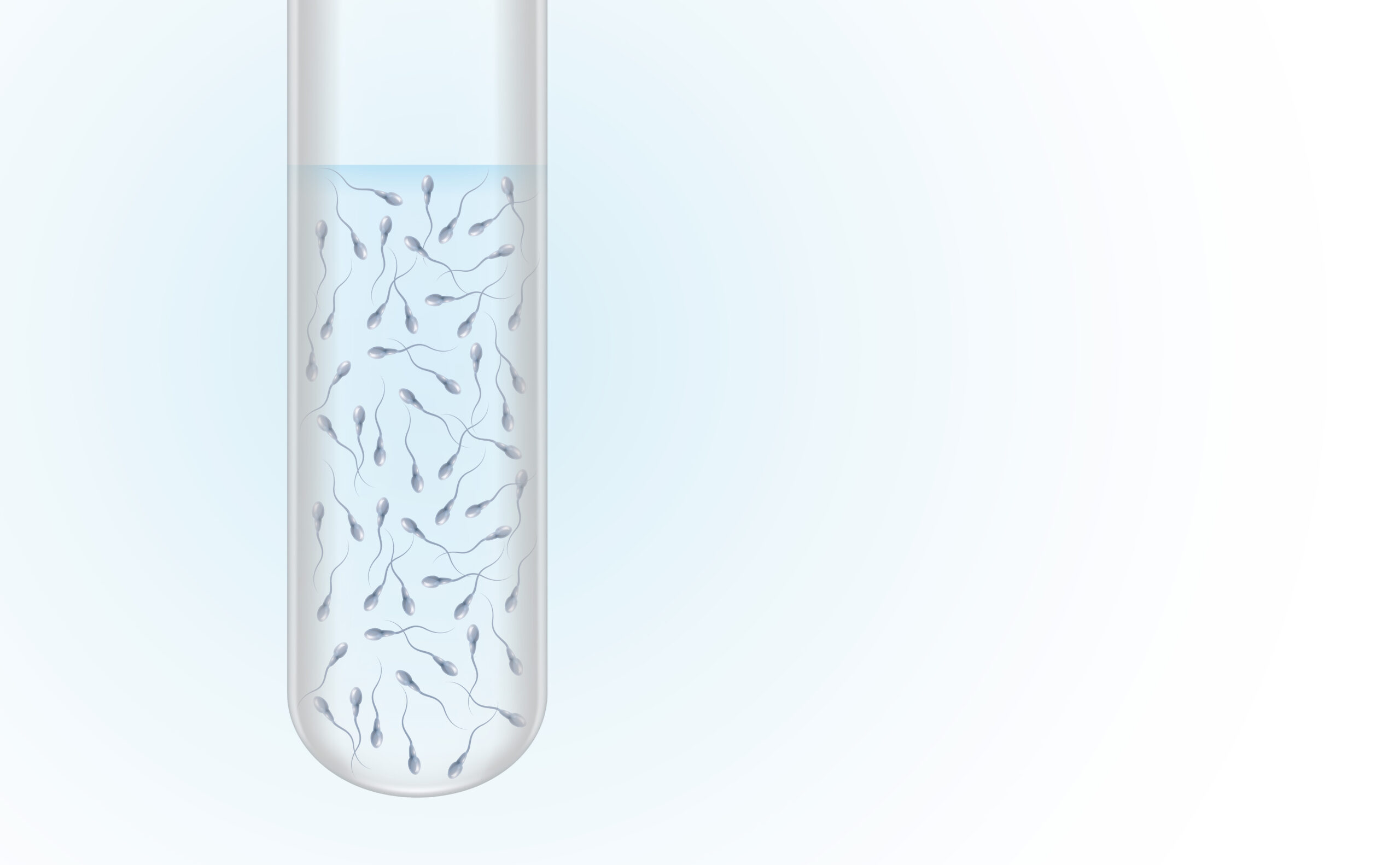 Azoospermia